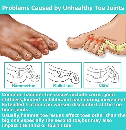 Byehambuni Hammer Toe Straightener, 6 Pack Hammer Toe Corrector for Women, Gel Toe Straighteners for Curled, Crooked, Bent, Claw, Hammertoes for Women and Men, 3 Different Sizes (White) - görsel 14