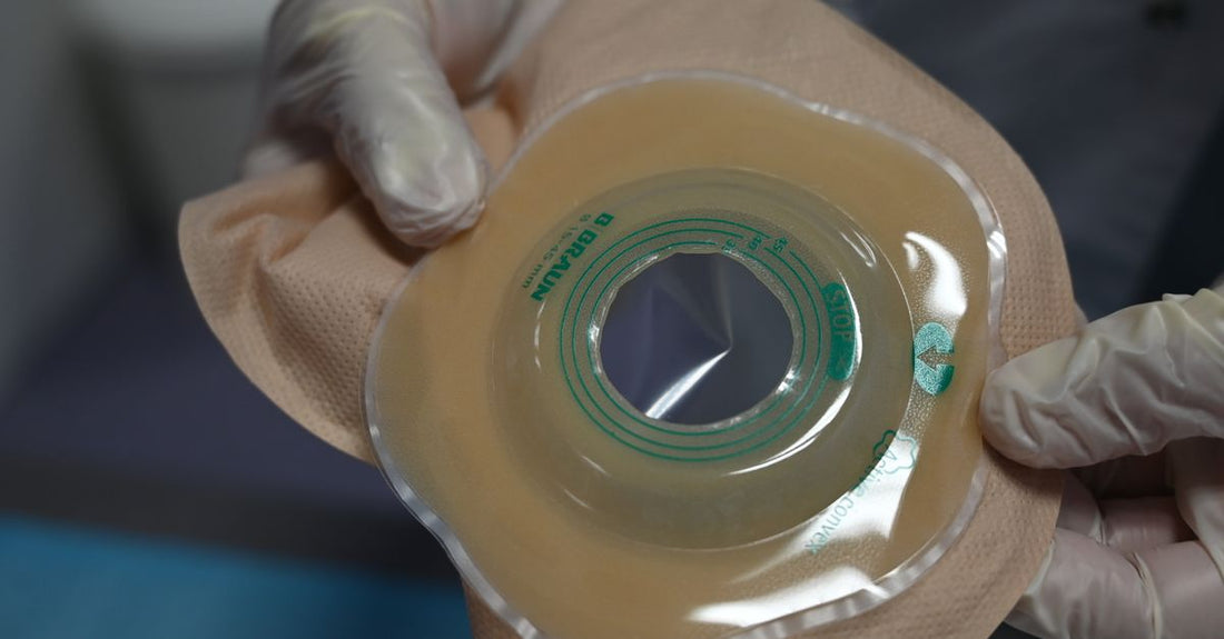 Various ostomy barrier rings and strips displayed on a clean surface, illustrating how to choose barrier rings & strips UK