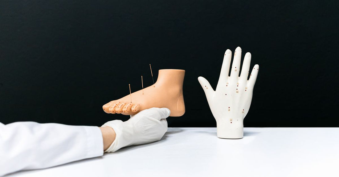 Collection of best acupuncture 2026 tools including ear seeds, acupuncture pen, and gua sha set on a wooden surface.