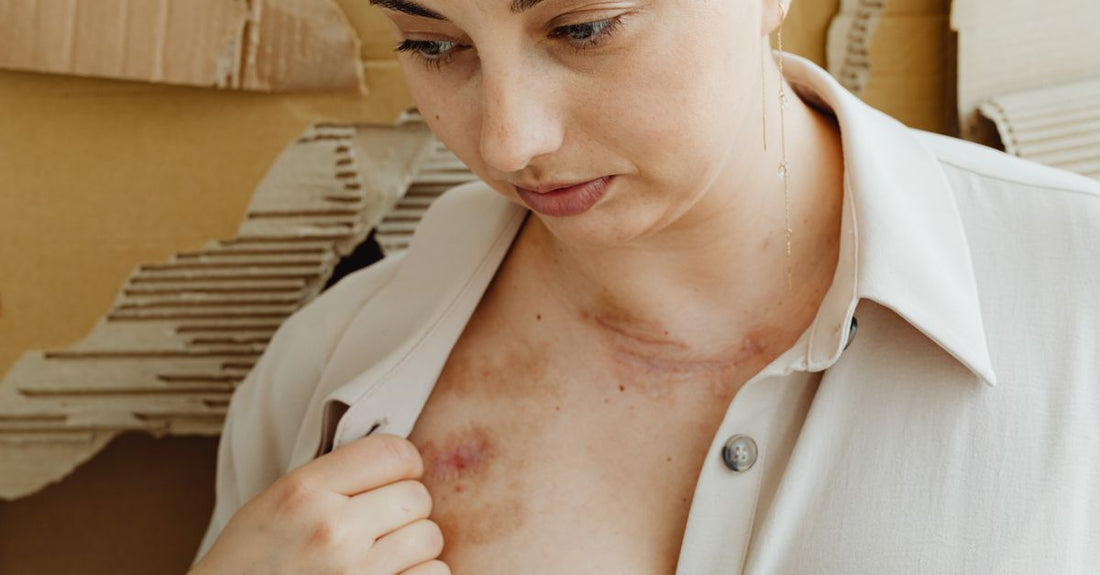 Collection of best scars & wounds UK 2026 products including silicone scar sheets and healing gels arranged on a clean surface.