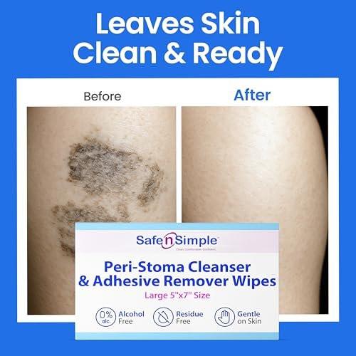 Safe n' Simple Adhesive Remover for Skin - 5"x7" 50 Wipes - Stoma Adhesive Remover Wipes - Alcohol Free Wipes for Sensitive Skin - No Sting Adhesive Remover Wipes - görsel 1