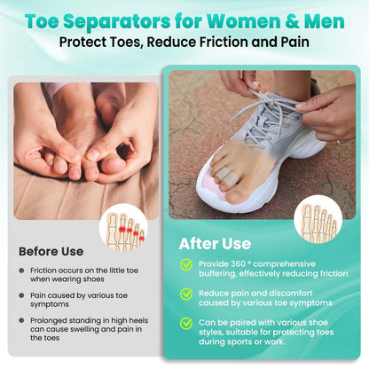 Pnrskter Silicone Toe Protectors for Women & Men, 20 PCS Pinky Toe Protector, Soft Toe Covers, Cuttable Toe Caps & Toe Sleeves, Corn Pads for Toes, for Blisters, Calluses, Hammer Toes & Rubbing Relief