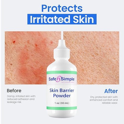 Safe n' Simple Stoma Skin Barrier Powder - 1 oz - Medicated Protective Skin Barrier Powder - Skin Barrier Protection Ostomy Powder Supplies - Stoma Adhesive Powder