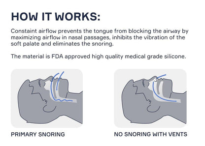 Snore Bastion Nasal Dilators for Sleeping – Set of 4 Large (L) Soft Nose Vents and Nostril Opener for Quiet Nights - Nasal Cones