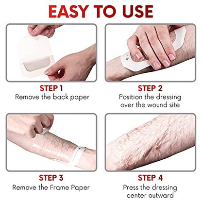 Transparent Film Dressing 2.3" x 2.75" (100 – Material: Polyurethane (PU) film with acrylic adhesive – Image 8