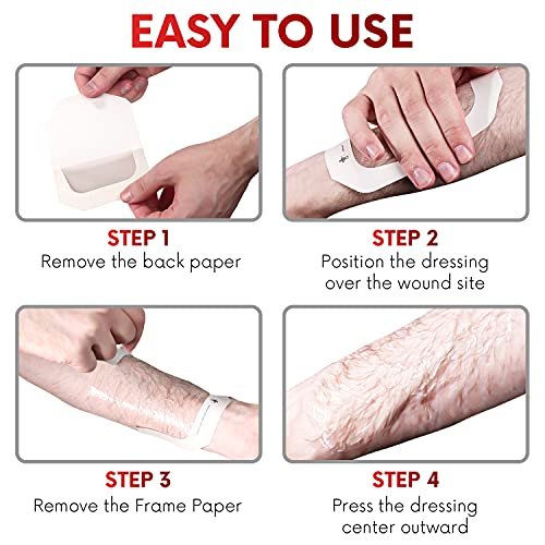 Transparent Film Dressing 2.3" x 2.75" (100 – Pack Quantity: 100 individually wrapped, sterile dressings – Image 9