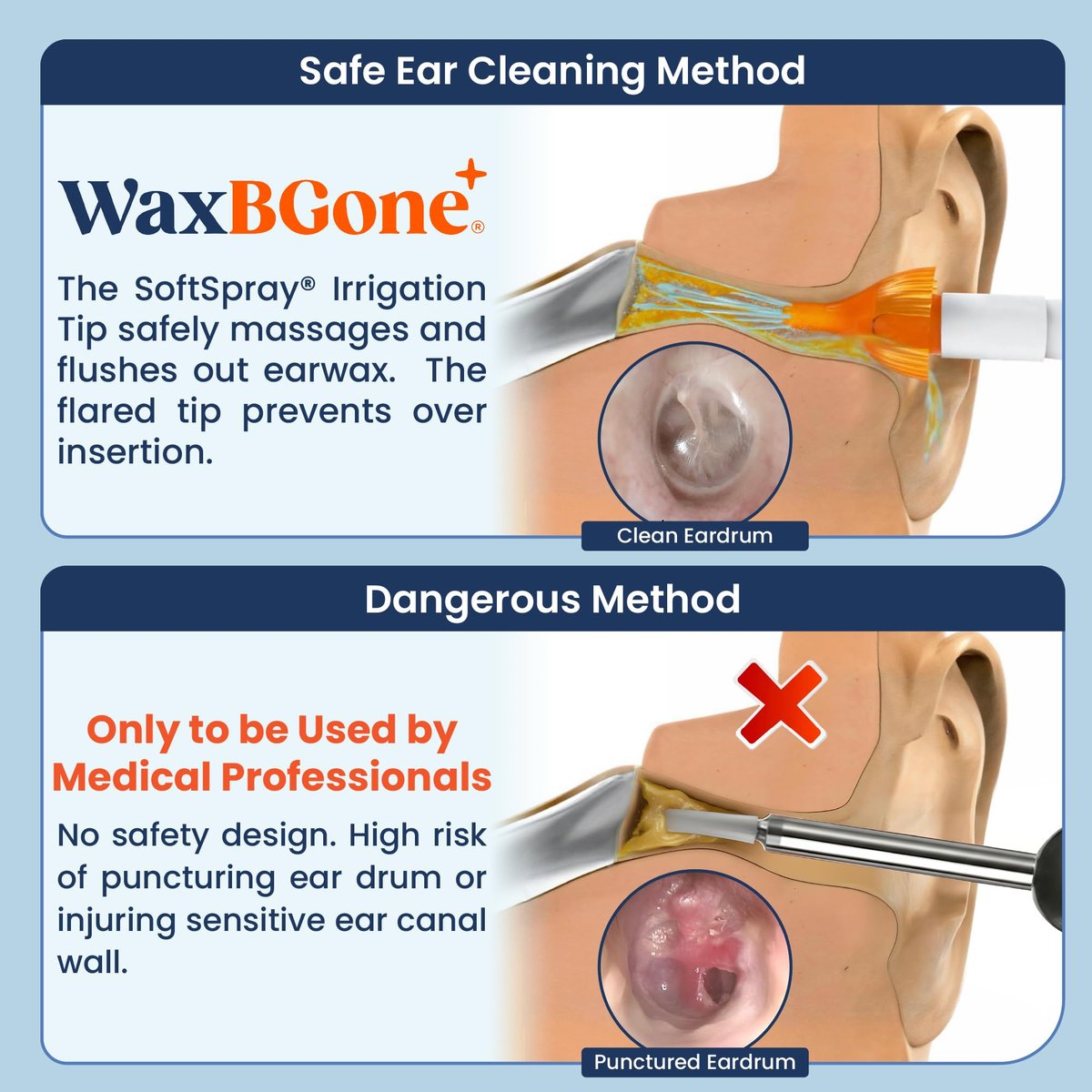 WaxBGone® Ear Wax Removal Kit with SoftSpray® Irrigation Tips, 4X High Output Sprayer & Ear Basin - Safe, Fast, Gentle Ear Cleaning Kit for Adults & Kids at Home - Standard Kit with Ear Drops - görsel 7