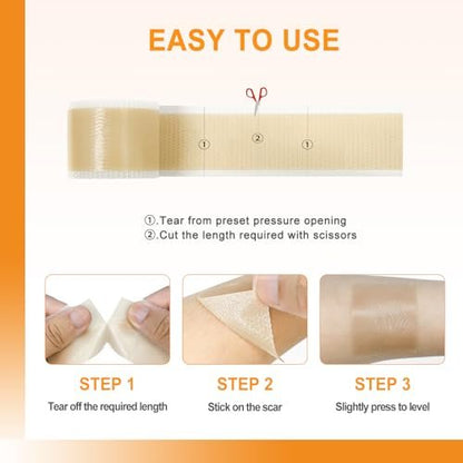 Silicone Scar Sheets (1" x 60" Roll), Soft – Easy-Tear Design: The roll can be easily cut to any length without – Image 3