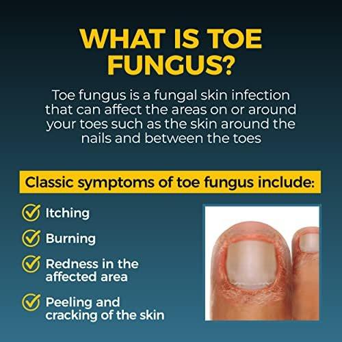 Fungi-Nail Pen Applicator Anti-Fungal Solution, Kills Fungus That Can Lead to Nail & Athlete’s Foot with Tolnaftate & Clinically Proven to Cure and Prevent Fungal Infections | 0.20 Fl Oz (Pack of 2) - görsel 5