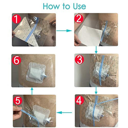 Waterproof Shower Cover Shields, Non-Stick Center Pad for Dialysis Port Picc Line Chest Catheter PD Peritoneal Dialysis Chemo Feeding Tube Peg G-Tube Patient Bandage Protector, 9"x9"(Pack of 25)