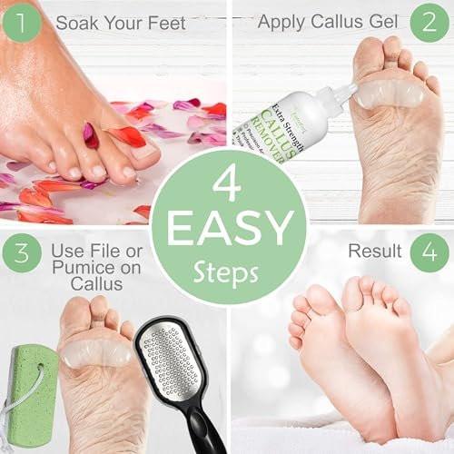 Dr. Entre's Callus Remover Gel Kit for Feet: Foot File, Pumice Stone, 5 Glove Pairs for Gel Application, Spa Kit, Foot Care, Pedicure Tools, Scrubber, 8oz - görsel 4
