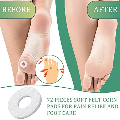 Nuanchu 72 Pcs Callus Cushions Corn Pads for Bottom of Foot Round Corn Cushions Pads for Feet Soft Adhesive Felt Callus on Ball and Side of Foot Pain Relief from Shoe - görsel 4