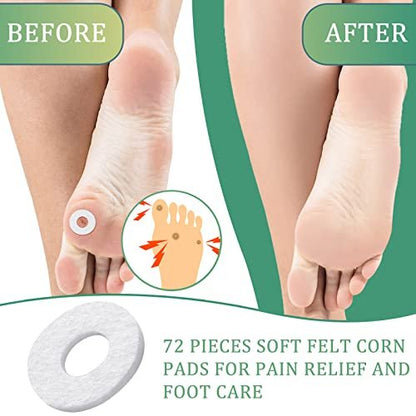 Nuanchu 72 Pcs Callus Cushions Corn Pads for Bottom of Foot Round Corn Cushions Pads for Feet Soft Adhesive Felt Callus on Ball and Side of Foot Pain Relief from Shoe