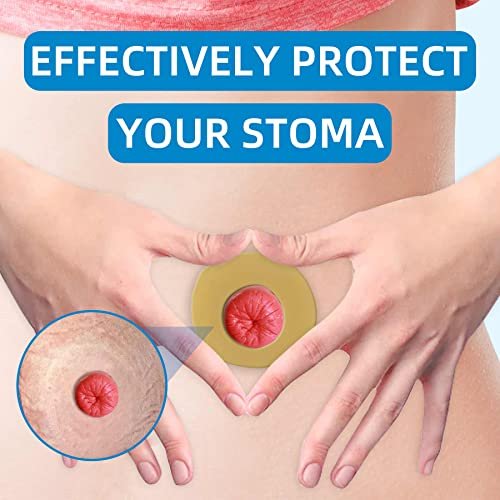10PCS Ostomy Barrier Rings, Sting Free – Quantity: 10 rings per pack – Image 9