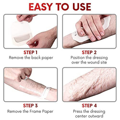 Transparent Film Dressing 2.3" x 2.75" (100 – Item Dimensions: 4.75" x 4.25" x 2.0" (pack) – Image 12