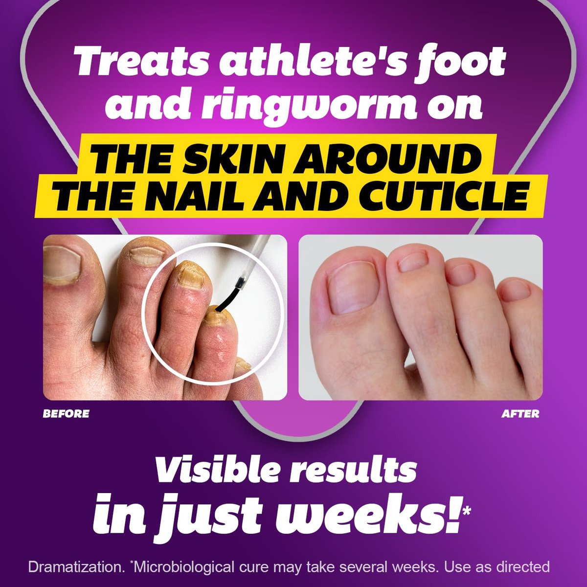 SILKA Max Strength Antifungal Liquid for Toenail Health with Brush Applicator, Results in 1 Week, Nail Fungus Treatment for Damaged Toenails, Athlete's Foot Treatment, Tolnaftate 1% 0.45 Fl Oz - görsel 14