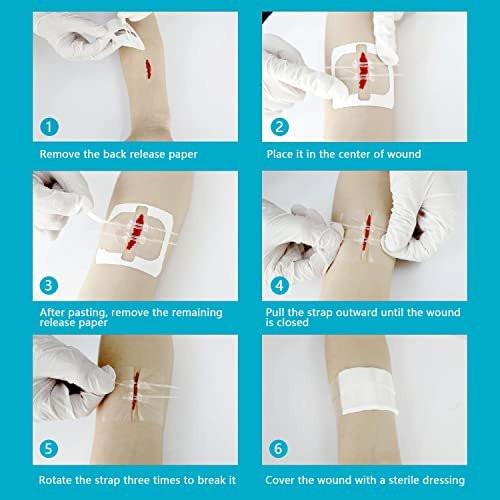 4 Pack Emergency Wound Closure Strips, Double Zip Wound Closure Device, Butterfly Stitches Alternative, Suture-Free Skin Closure for Home First Aid Kits & Outdoor Use - görsel 11