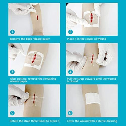 4 Pack Emergency Wound Closure Strips, Double Zip Wound Closure Device, Butterfly Stitches Alternative, Suture-Free Skin Closure for Home First Aid Kits & Outdoor Use