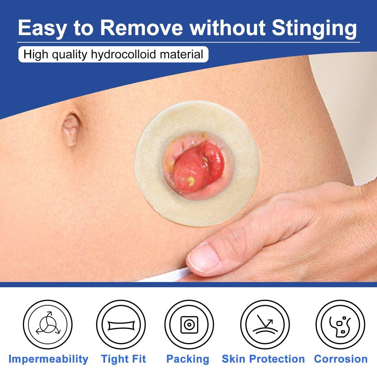Carbou Ostomy Barrier Rings - Outer Diameter: 2" (50mm) 3.5mm Thickness, Compatible with All Bag Types and Brands (2" (Pack of 10)) - görsel 9