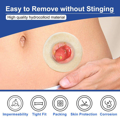 Carbou Ostomy Barrier Rings - Outer Diameter: 2" (50mm) 3.5mm Thickness, Compatible with All Bag Types and Brands (2" (Pack of 10))