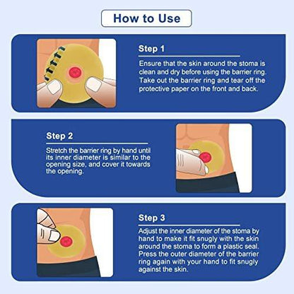 Carbou Ostomy Barrier Rings - Outer Diameter: 2" (50mm) 3.5mm Thickness, Compatible with All Bag Types and Brands (2" (Pack of 10))