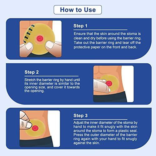 Carbou Ostomy Barrier Rings - Outer Diameter: 2" (50mm) 3.5mm Thickness, Compatible with All Bag Types and Brands (2" (Pack of 10)) - görsel 3