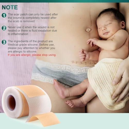 Silicone Scar Sheets, Silicone Scar Tape (1.6"x 120" Roll-3M), Reusable and Effective Scar Removal Sheets, Silicone Scar Removal Sheets for Surgical Scars, Healing Keloid, C-Section, Tummy Tuck - görsel 3