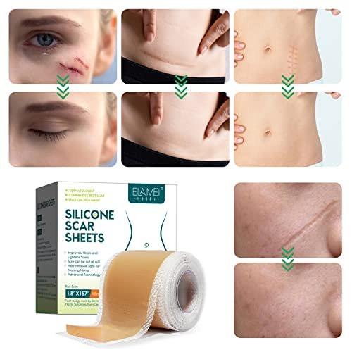 Silicone Scar Sheets (1.8” x 157” Inch - 4M), Scar Tape, Scar Strips, Medical Grade, Scar Remover, C-Section, Surgery, Keloid, Tummy Tuck, Scar Patch - görsel 7