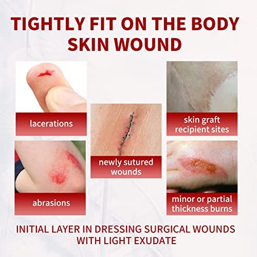POLYNEW Xeroform Petrolatum Dressing 4"x4", 25 PCS Non-Adherent Gauze for Low Exudating Wounds, Fine Mesh Gauze Pads for Burns, Abrasions, Lacerations, Skin Grafts and Surgical Incisions - görsel 16