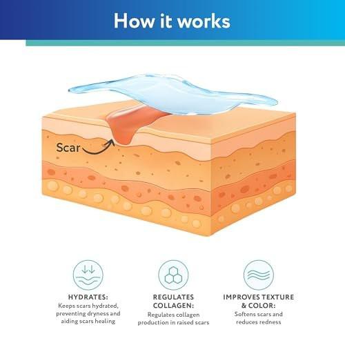 ScarAway Silicone Scar Gel, Helps Improve – Versatile Application: Ideal for scars on any part of the body, – Image 16