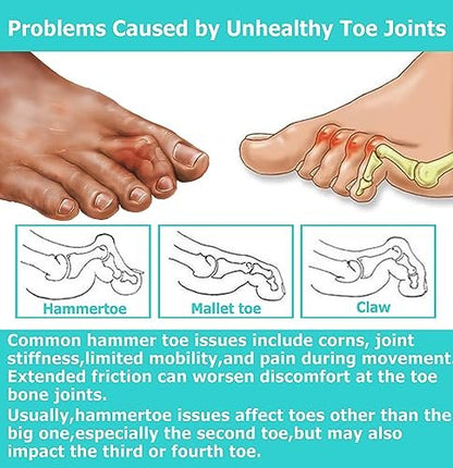 Byehambuni Hammer Toe Straightener, 6 Pack Hammer Toe Corrector for Women, Gel Toe Straighteners for Curled, Crooked, Bent, Claw, Hammertoes for Women and Men, 3 Different Sizes (White)
