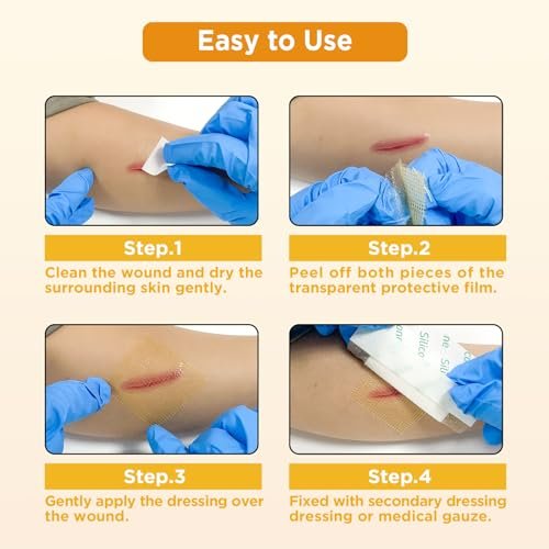 Ceeport Manuka Honey Gauze Wound Dressing 2" x 2", 10 Pack Manuka Honey Wound Care Pads, Medical Grade Honey Bandages for Wound Care, Honey Patch for Faster Healing from Burns, Abrasions, Cuts and Scalds - görsel 2