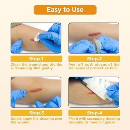 Ceeport Manuka Honey Gauze Wound Dressing 2" x 2", 10 Pack Manuka Honey Wound Care Pads, Medical Grade Honey Bandages for Wound Care, Honey Patch for Faster Healing from Burns, Abrasions, Cuts and Scalds