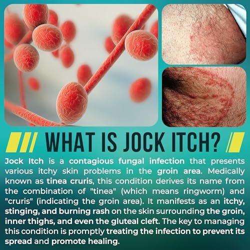 Jock Itch Cream | Extra Strength Antifungal – Versatile Use: Effective on multiple areas: groin, inner thighs, – Image 10