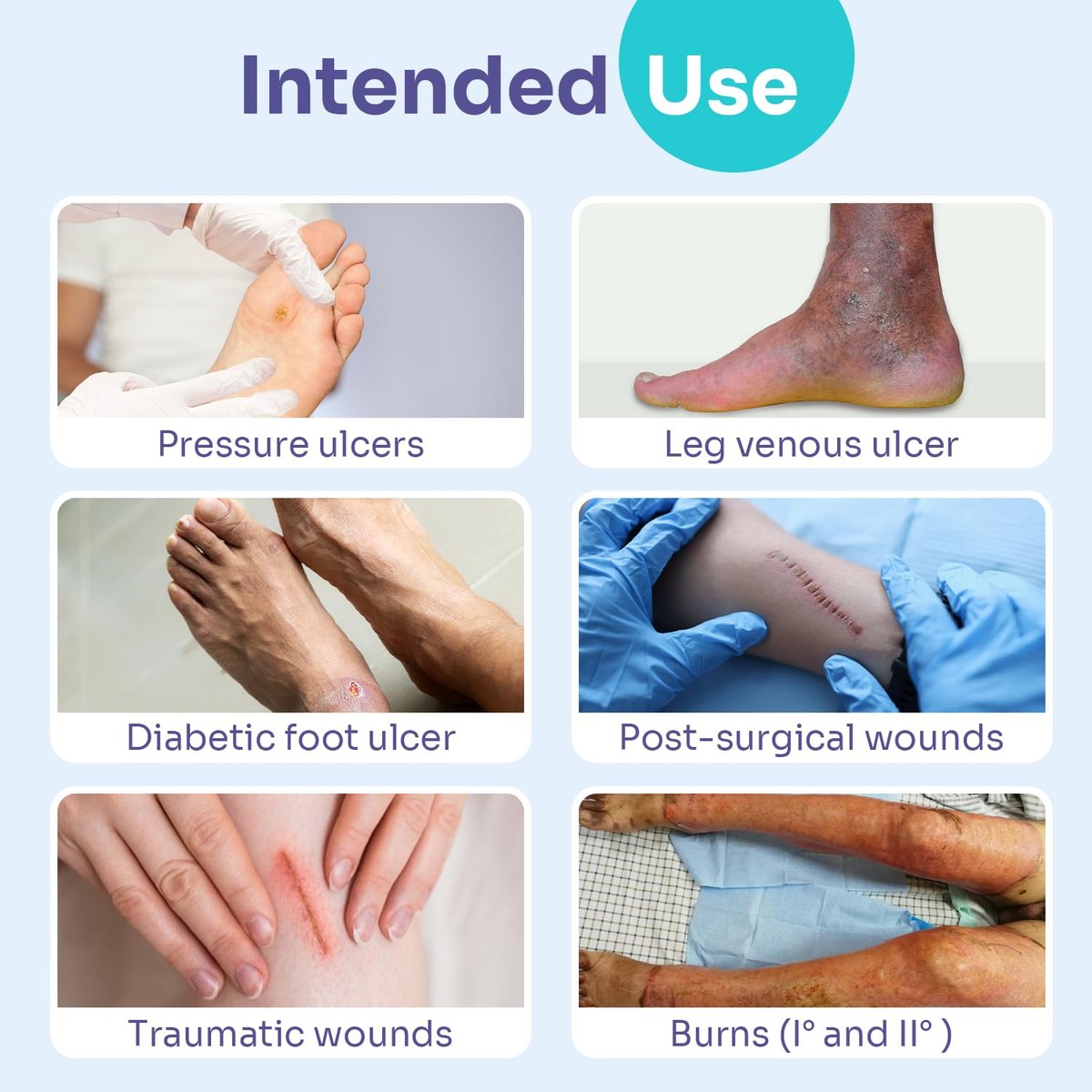 Conkote 10 Pack Foam Dressings Sterile Non-Adhesive Pads for Exudating Wounds 4"x4", FSA or HSA Highly Absorbent Waterproof Dressings for Wound Care, Ulcers, Post Op Trauma, Injuries, Burn - görsel 16