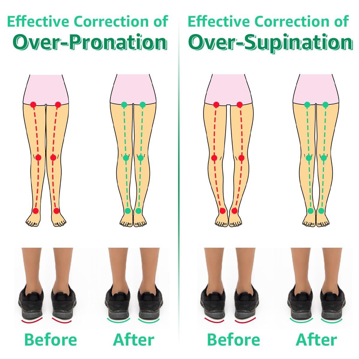 Skyfoot 3 Layers Adjustable Heel Wedge Inserts for Supination & Pronation Correction, Adhesive Medial & Lateral Heel Insoles for Bow Legs, Knee Pain, Foot Alignment (L: W 7-11, M 7-10, Crystal) - görsel 12