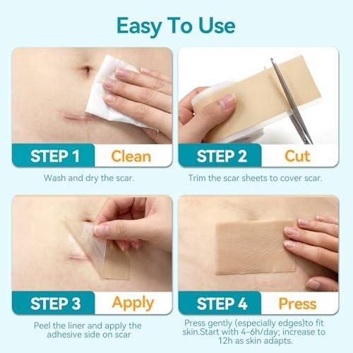 Dimora UPF50+ Silicone Scar Sheets with UV Protection Reusable Sheets to Soften, Flatten Fade Scars, Reduce Redness for Surgical, C-Section, Burn, Keloid, and Hypertrophic Scars (1.6”x78.7" Roll) - görsel 1