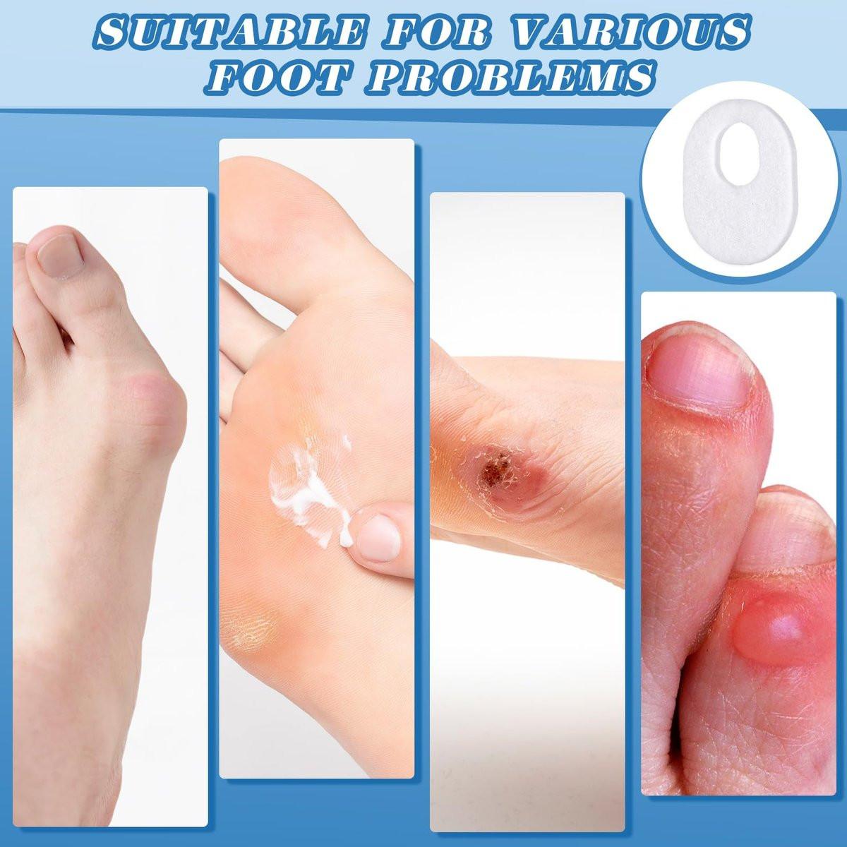WILLBOND 120 Pcs Callus Pads Soft Felt Callus Oval Shape Corn Pads for Bottom of Foot Adhesive Foot Corn Cushion for Men and Women Feet Toes Heel Pain Relief (White) - görsel 10