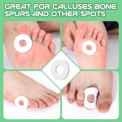 Nuanchu 36 Pcs Callus Cushions Corn Pads for Bottom of Foot Round Corn Cushions Pads for Feet Soft Adhesive Felt Callus on Ball and Side of Foot Pain Relief from Shoe