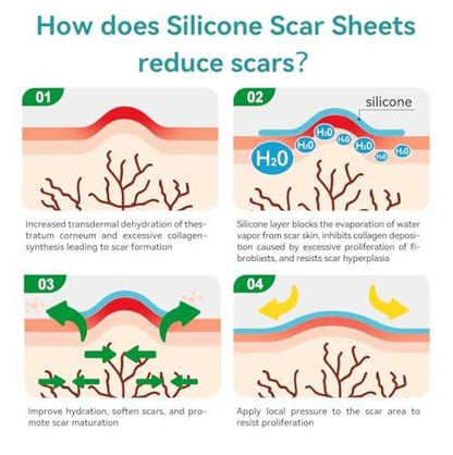 Dimora Medical Grade Silicone Scar Sheets - Ultra Soft Silicone Scar Tape (1.6”x120 Roll), Waterproof Scar Treatment for Surgical Scars, C Section, Tummy Tuck, Keloid Treatment