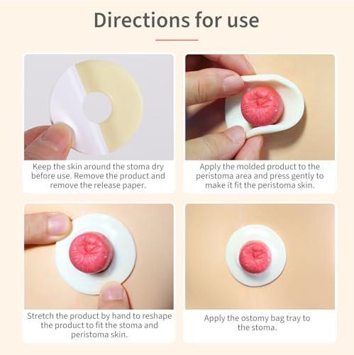 DERAYMI 10 Pack Moldable Ostomy Barrier Rings, 2mm Thickness Barrier Rings for Ostomy Bags, Sting-Free Hydrocolloid Ileostomy Elastic Ostomy Rings Secure Seal for Colostomy Bags - görsel 2