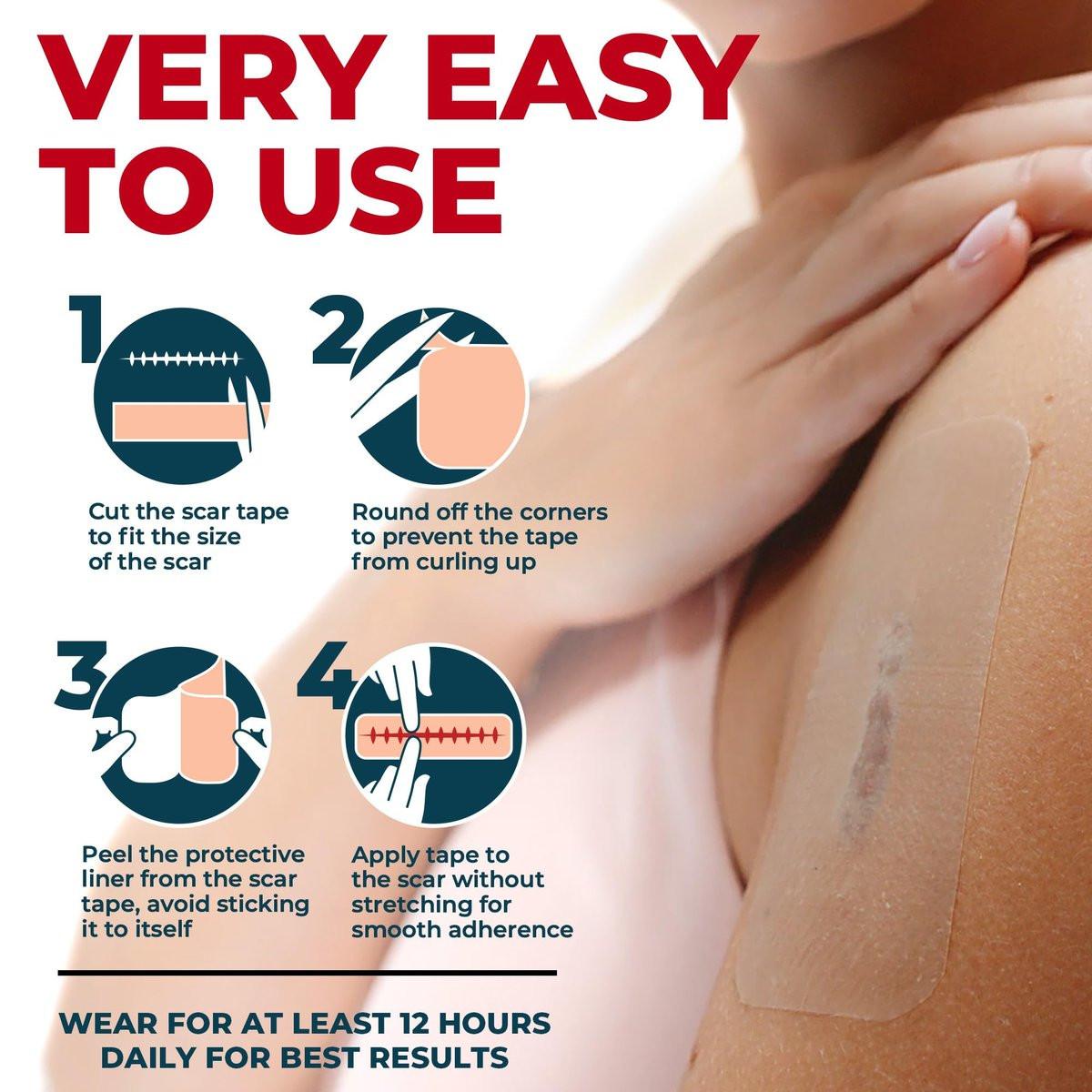Medical Grade Silicone Scar Tape - Transparent (1.6”x150”) - Visible Difference on Surgical & Keloid Scars - Reusable Silicone Scar Sheets - Easy to Use Silicone Tape for Scars - görsel 9