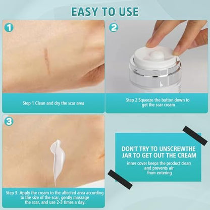 Pumkot Advanced Scar Cream, Silicone Gel for Scars, Professional Scar Removal Cream for Surgical Scars, Stretch Marks, Old and New Scars 1.7 oz (50ml)