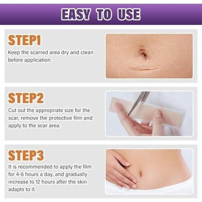 Silicone Scar Sheets, Medical Grade Silicone Scar Tape for Surgical, Hypertrophic, Keloid, C-Section, Burn, Old & New Scars, Reusable Professional Scars Removal Sheets (1.6"X 120" Roll-3M)