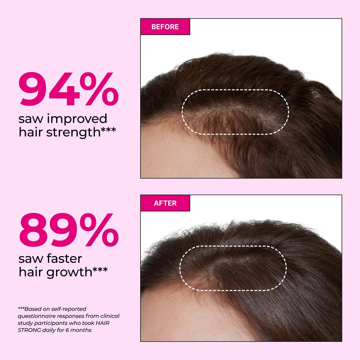 HUM Hair Strong Daily Hair Growth Supplement with Biotin, Zinc, Vitamin B12 to Support Growth, Folic Acid & Vitamin B12 Vitamins for Healthy Hair Support for Women and Men, 30 Vegan Capsules - görsel 5