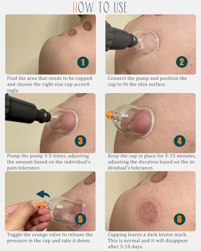 DEFUNX 12 Cups Cupping Set - Cupping Kit for – Item Weight: 1.0 pounds – Image 10