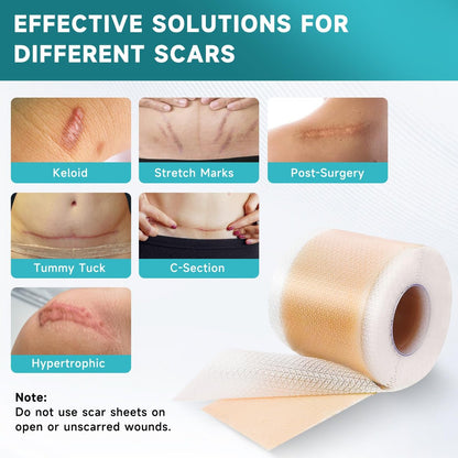 Pumkot Silicone Scar Sheets, Silicone Scar – Discreet & Breathable: The brown color blends with most skin tones, – Image 5