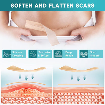 Pumkot Silicone Scar Sheets, Silicone Scar – Upgraded Stickiness: The enhanced adhesive ensures the tape stays in – Image 7