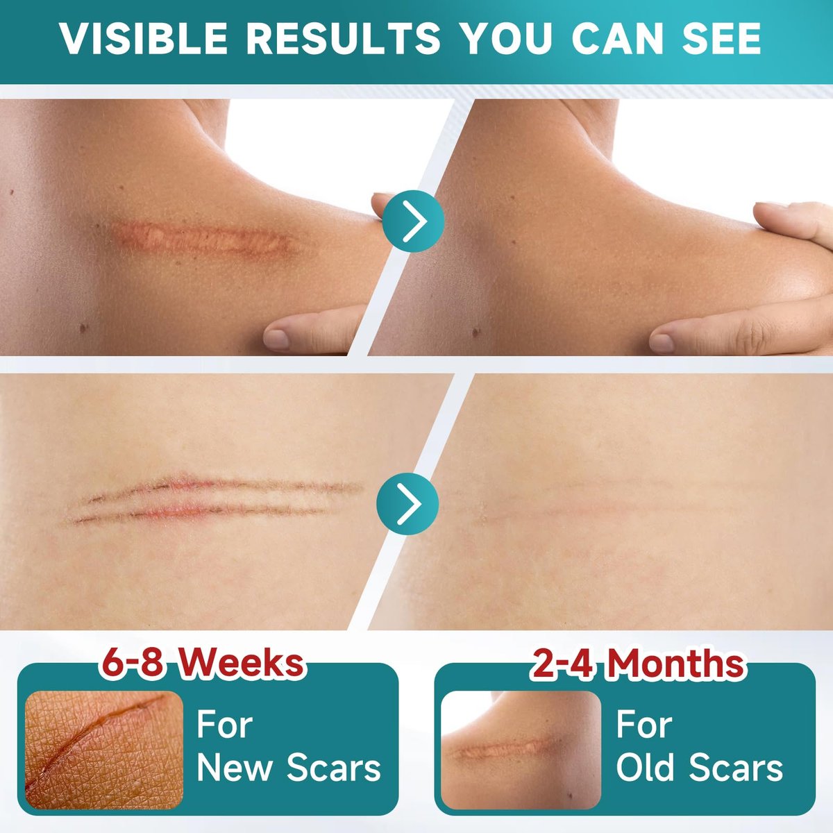 Pumkot Silicone Scar Sheets, Silicone Scar – Waterproof & Reusable: The tape is waterproof, allowing you to wear – Image 3