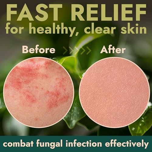 Body Spray with Tea Tree Oil | – Application: Spray directly onto affected area – Image 8